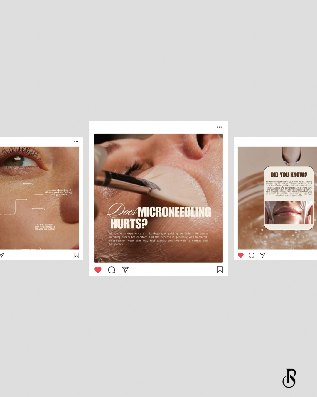Microneedling Essential Edit