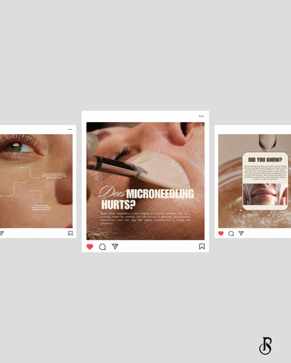 Microneedling Essential Edit
